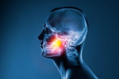 A computer-generated image of a human jaw under X-ray exposure
